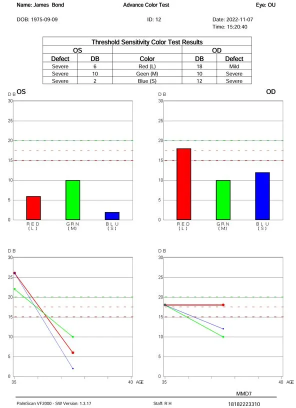 A color test report for James Bond shows two bar graphs comparing sensitivity to red, green, and blue for each eye (OS and OD). Below are line charts showing color sensitivity by age for each eye.