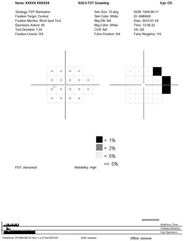 Visual field test result chart showing a grid with varying grayscale squares indicating vision response, plus patient info, test strategy, reliability score, and an overall Abnormal result for the left eye (OS).