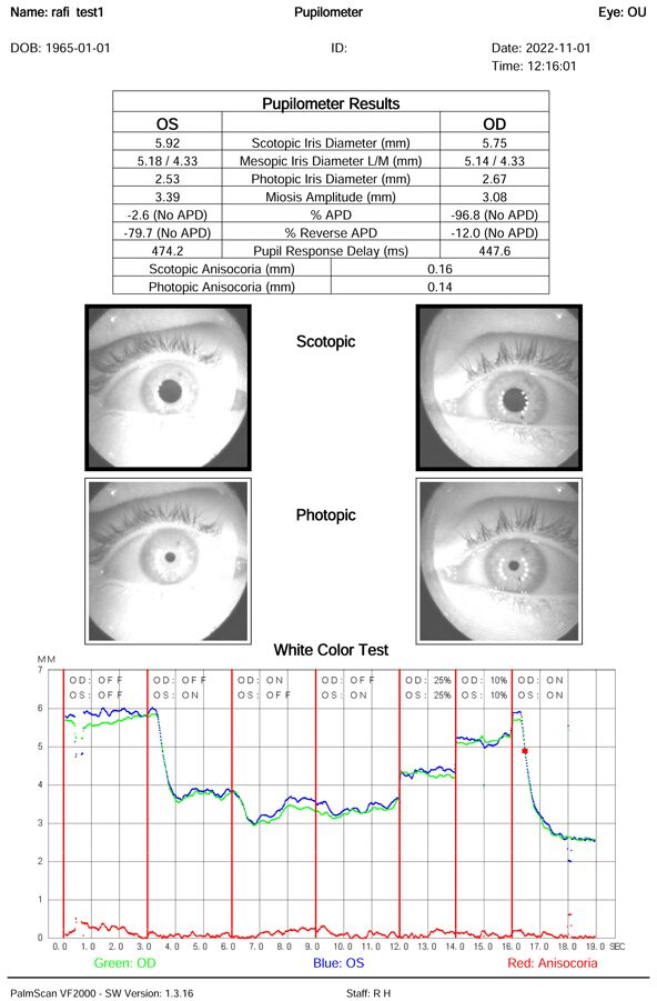 A medical report shows pupil measurements, two close-up eye images under different lighting (scotopic and photopic), and a graph with colored lines representing white color test data.