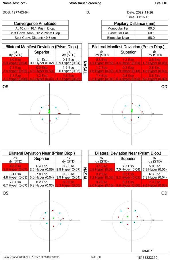 A strabismus screening report with numerical results and graphs for right and left eyes, showing measurements of deviation in various gaze directions, highlighted in red and green, with test date and patient information.